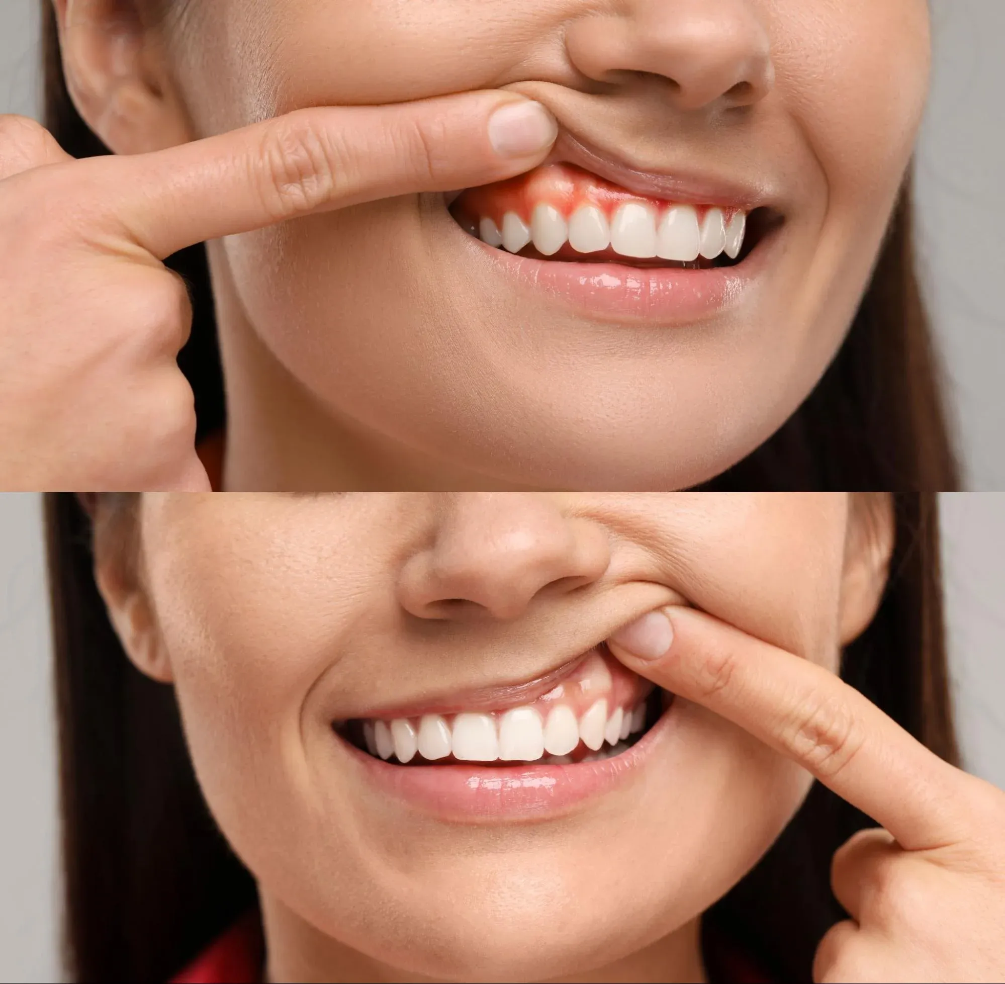 İsü Dent Logo